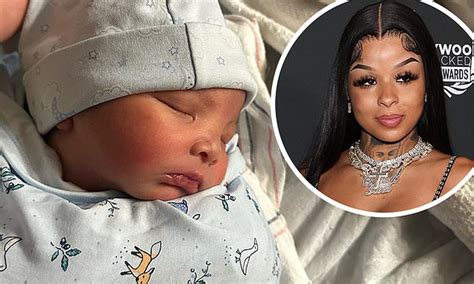 why does chrisean baby cry like that|Chrisean Rock Denies Her Son Has Cri Du Chat Syndrome (Video)